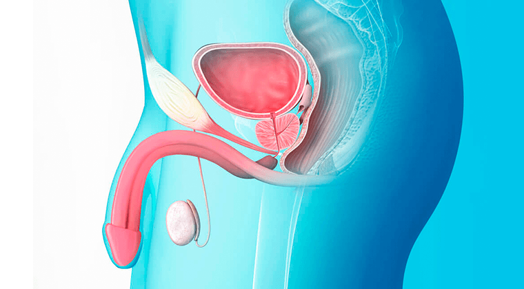 Estenosis Uretral