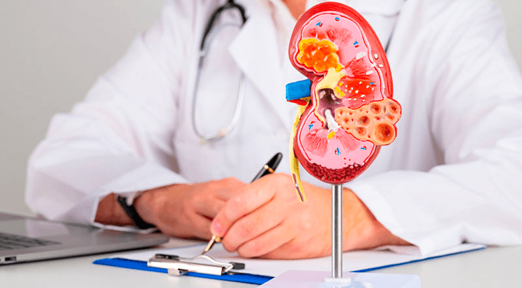 Urología General