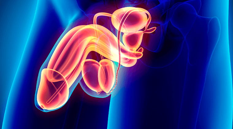 Disfunción Eréctil