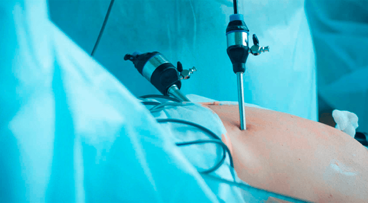 Cirugía Mínimamente Invasiva