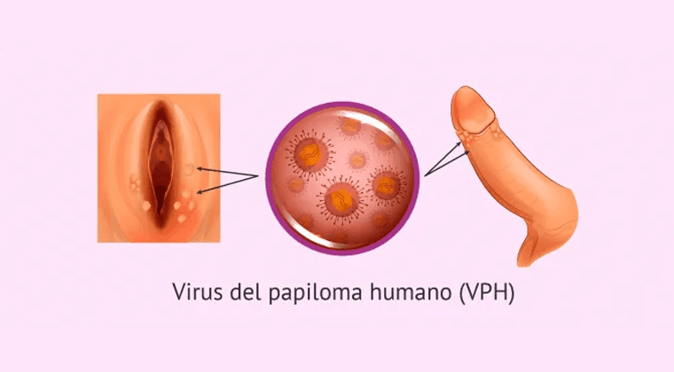 Diagnóstico y Tratamiento de Enfermedades de Transmisión Sexual (ETS) en Hombres