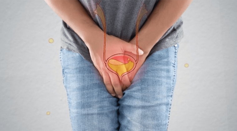 Disuria (Dolor o Ardor al Orinar)